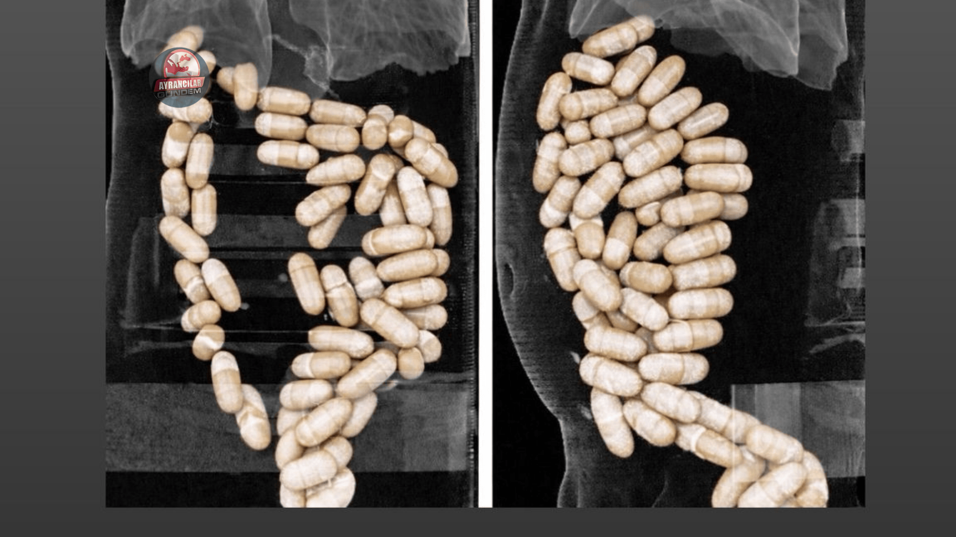 İzmir Havalimanı Uyuşturucu Kuryelerini Yakaladı